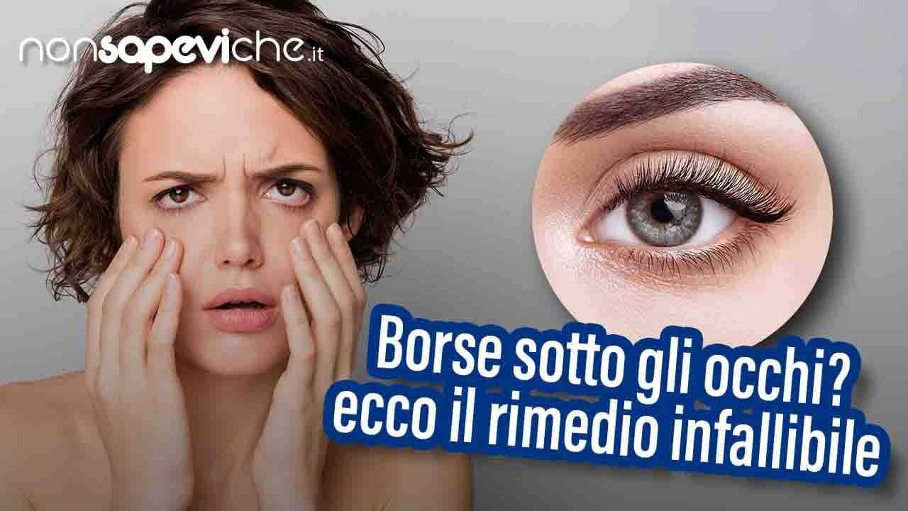 Borse sotto gli occhi fisse al mattino, ecco il rimedio infallibile