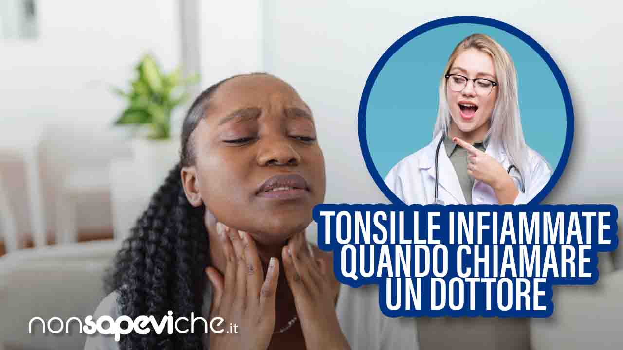 Tonsille ipertrofiche (o infiammate) quando rivolgersi subito al medico