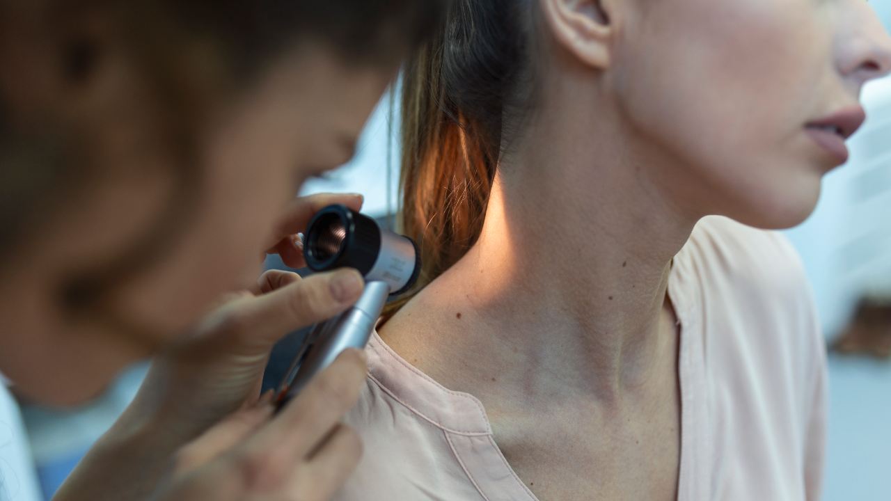 Melanoma: scoperta nuova strategia terapeutica che lo contrasta